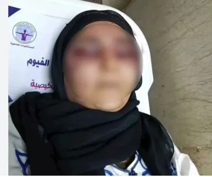 تفاصيل أعتداء  زوج على زوجته في طامية بالفيوم ...ضربها بقطعة حديد وأصاب وجهها وعينيها